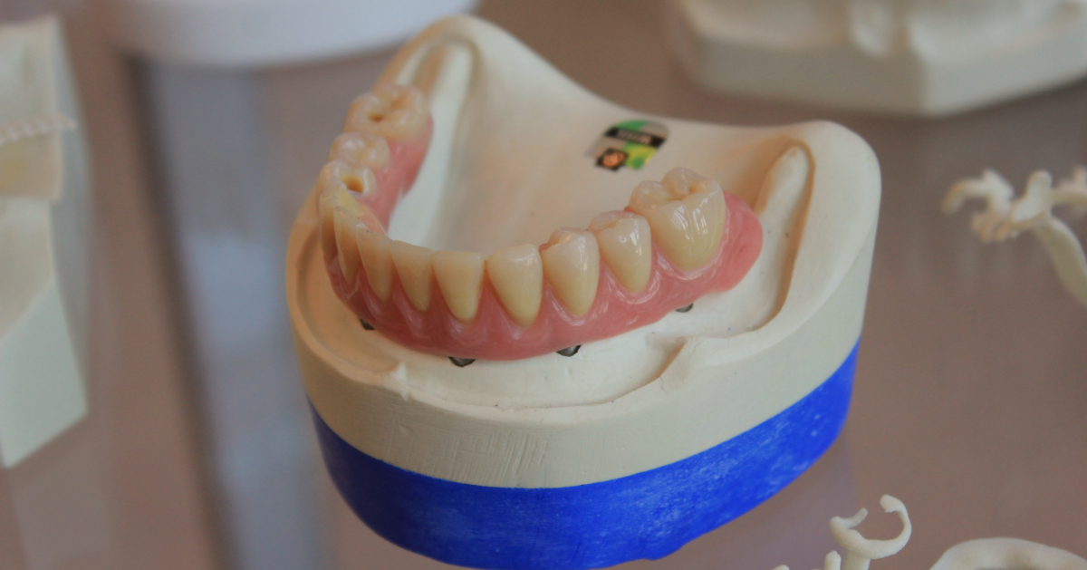 meloen karbonade zo veel Veel patiënten met gebitsprothese onnodig verzekerd voor tandartskosten' |  CTI Warmond